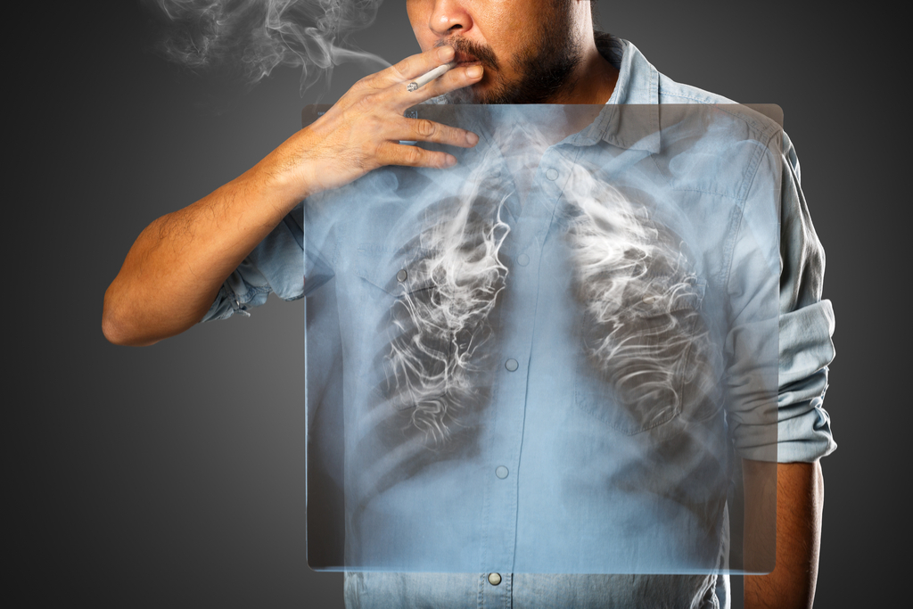 Man with Lung Cancer Diseases That Affect Men