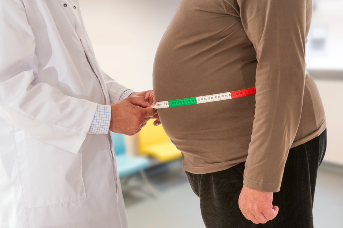 Doctor measuring obese man waist body fat. Obesity and weight to loose.