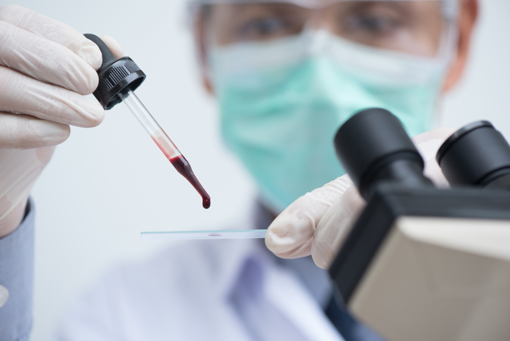 A lab technician putting a blood sample onto a microscope slide