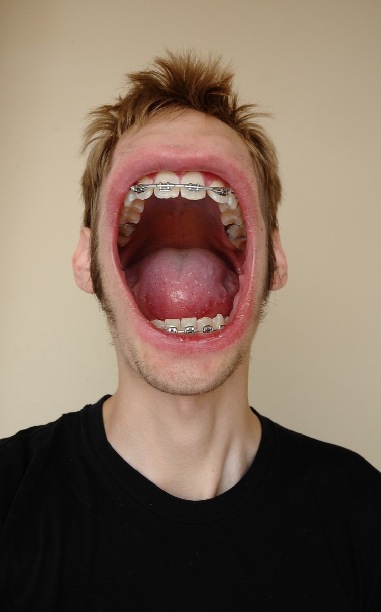 Man With Huge Screaming Mouth on His Face Funny Stock Photos