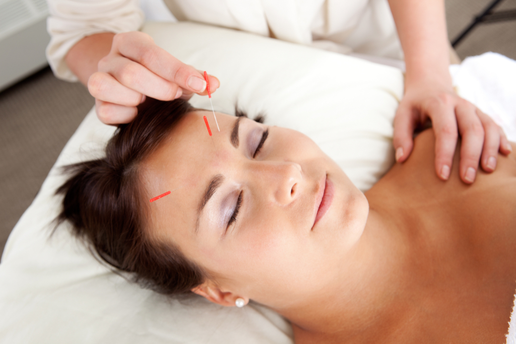 Facial Acupuncture perfect nap