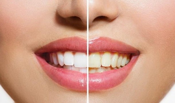 Bye-bye white teeth | 7 Reasons To Switch From Coffee To Tea | Her Beauty